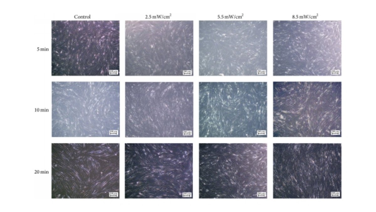 Empowering Healing: Photobiomodulation Therapy in Chronic Wound Care - Lumaflex